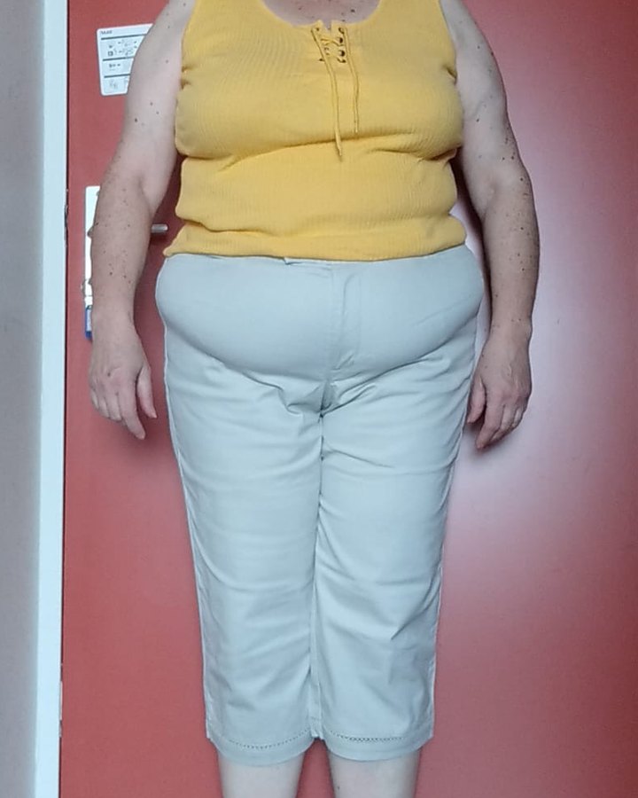 Before, photo shared by a client, face hidden
