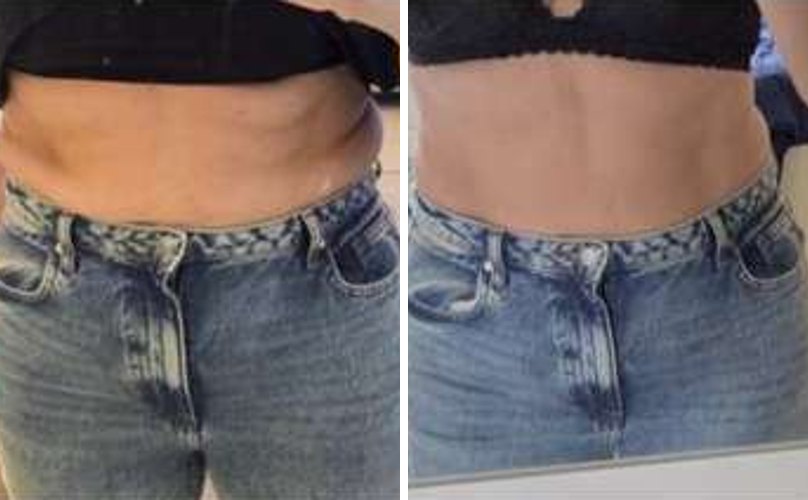 Before and after screenshot shared by a client